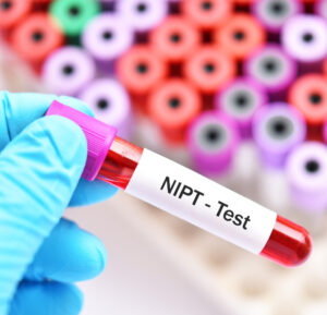 NIPT test