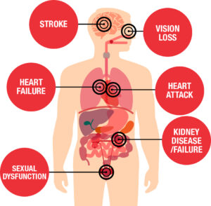 Risks associated with high blood pressure