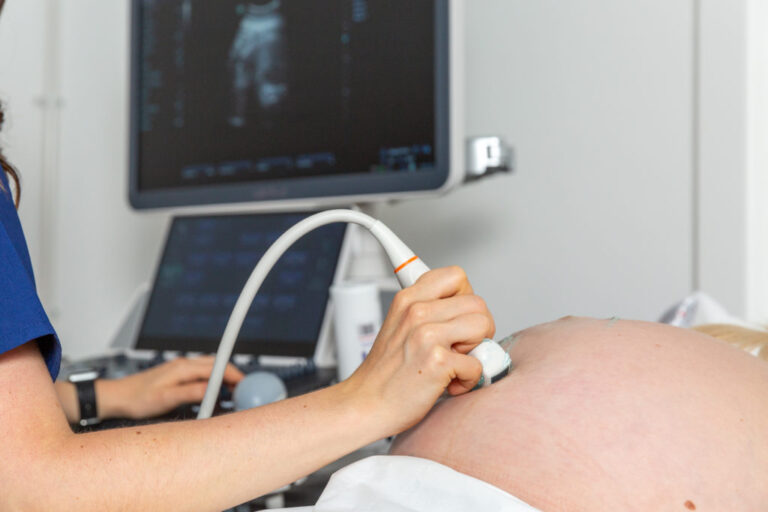 What You Need to Know About Pregnancy Ultrasound Scans