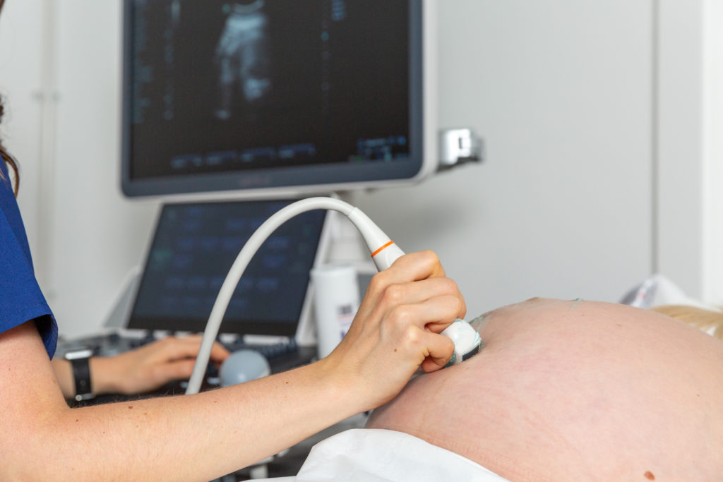 What You Need To Know About Pregnancy Ultrasound Scans