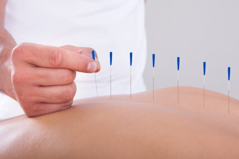 The Unknown Health Benefits of Acupuncture