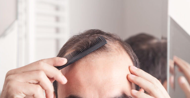 5 Hair Loss Myths Debunked