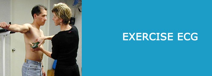 Importance of exercise ECG