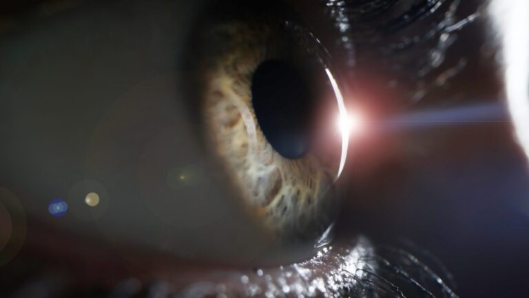 Lasik laser eye surgery