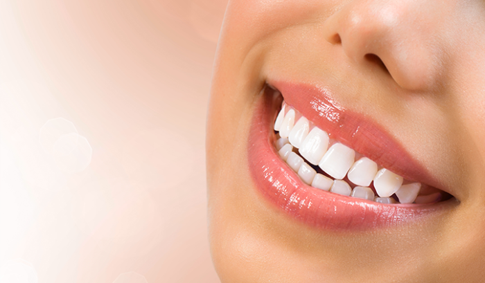How Laser Teeth Whitening Works