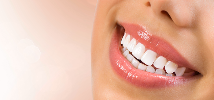 How Laser Teeth Whitening Works