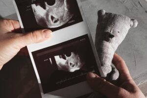 pictures of baby ultrasound